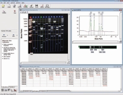 Gel Dokumentationssystem microDOC mit UV-Transilluminator